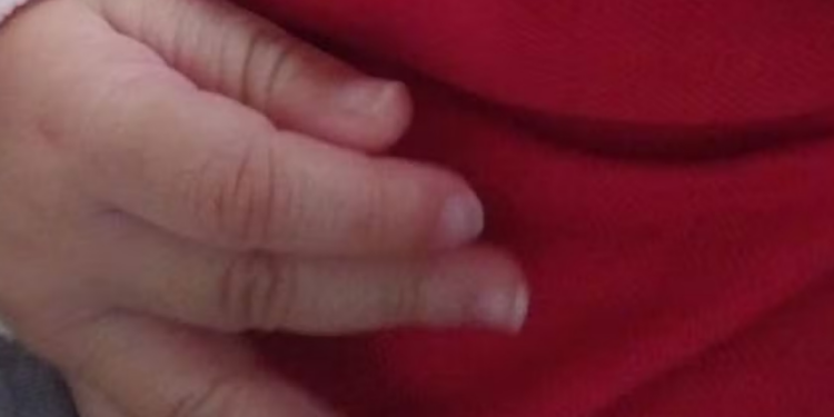Bebê de 7 meses é internado com costela quebrada e lesão no crânio; mãe é presa em MS